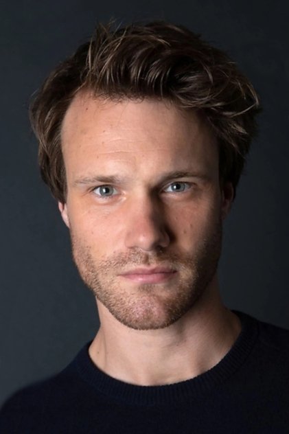 Hugh Skinner oyuncu görseli